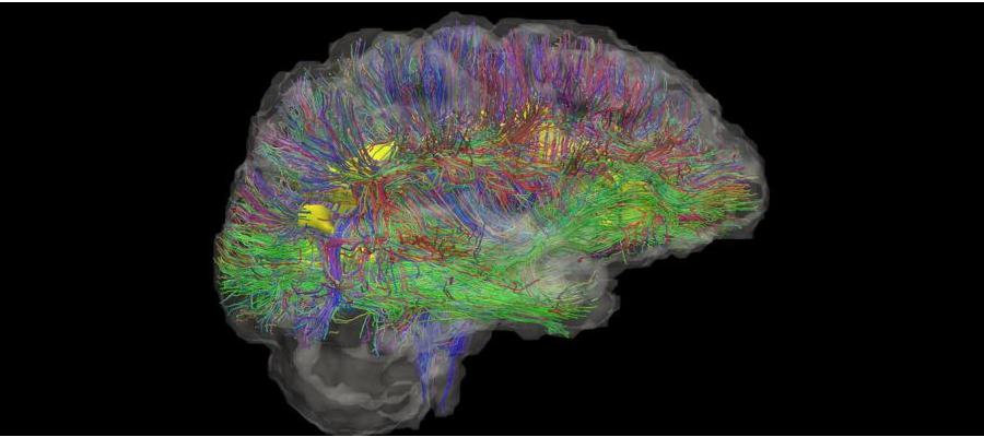 ECAS-brain-900x400